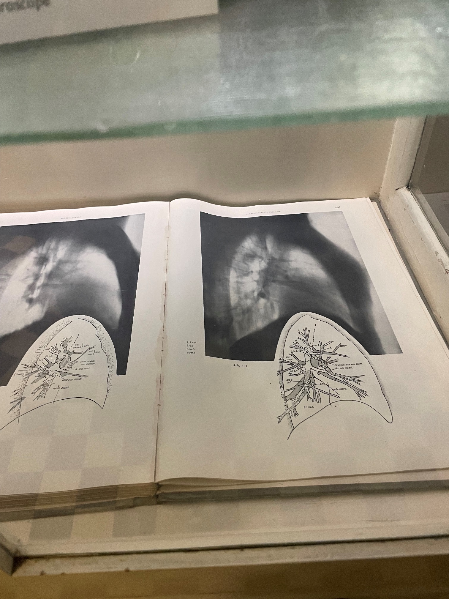Radiological service, Hospital in the Rock Museum, Budapest, by Maria Sofia Caracò - 09.jpeg
